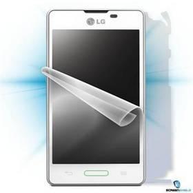 Ochranná fólie Screenshield na celé tělo pro LG E460 Optimus L5 II (LG-E460-B)